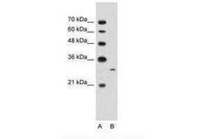Image no. 2 for anti-MAP3K7 C-Terminal Like (MAP3K7CL) (AA 151-200) antibody (ABIN203427) (MAP3K7CL Antikörper  (AA 151-200))