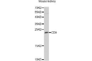 Western blot analysis of extracts of mouse kidney, using CD9 Antibody (ABIN5970852) at 1/1000 dilution. (CD9 Antikörper)