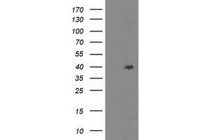 Western Blotting (WB) image for anti-TBC1 Domain Family, Member 21 (TBC1D21) antibody (ABIN1501317) (TBC1D21 Antikörper)