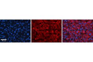 Rabbit Anti-FBXO21 Antibody Catalog Number: ARP43176_P050 Formalin Fixed Paraffin Embedded Tissue: Human Liver Tissue Observed Staining: Cytoplasm in hepatocytes Primary Antibody Concentration: 1:100 Other Working Concentrations: 1:600 Secondary Antibody: Donkey anti-Rabbit-Cy3 Secondary Antibody Concentration: 1:200 Magnification: 20X Exposure Time: 0. (FBXO21 Antikörper  (C-Term))