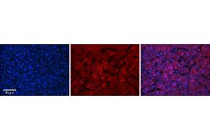 Rabbit Anti-UGT1A7 Antibody      Formalin Fixed Paraffin Embedded Tissue: Human Adult Liver   Observed Staining: Cytoplasm in hepatocytes, strong signal, wide tissue distribution  Primary Antibody Concentration: 1:100  Secondary Antibody: Donkey anti-Rabbit-Cy3  Secondary Antibody Concentration: 1:200  Magnification: 20X  Exposure Time: 0. (UGT1A7 Antikörper  (N-Term))