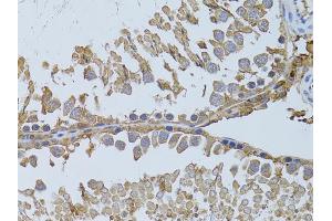 Immunohistochemistry of paraffin-embedded rat testis using HDAC8 antibody (ABIN5973443) at dilution of 1/100 (40x lens). (HDAC8 Antikörper)