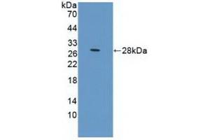 Detection of Recombinant PRLR, Human using Polyclonal Antibody to Prolactin Receptor (PRLR) (Prolactin Receptor Antikörper  (AA 25-234))