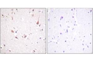 Immunohistochemistry analysis of paraffin-embedded human brain tissue, using Mst1/2 (Ab-183) Antibody. (MST1/MST2 (AA 149-198) Antikörper)