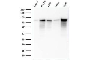Western Blot Analysis of MCF-7, HEK-293, A549, SKBr3, HeP2 lysate using MCM7 Mouse Monoclonal Antibody (SPM379). (MCM7 Antikörper)