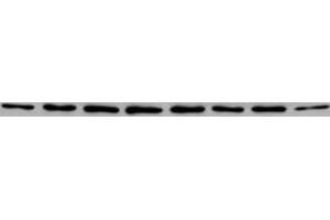 Western blot for anti-PABP on HeLa cell extracts (left lane) (PABP Antikörper)