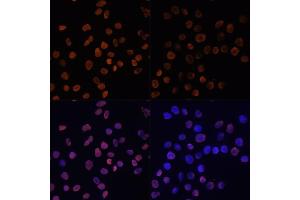 Immunofluorescence analysis of HeLa cells using Acetyl-Histone H2A-K5 antibody (ABIN7267722) at dilution of 1:100. (Histone H2A Antikörper  (acLys5))