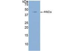 Detection of Recombinant NPPA, Mouse using Polyclonal Antibody to Natriuretic Peptide Precursor A (NPPA) (NPPA Antikörper  (AA 25-152))