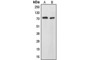 Western blot analysis of EOMES expression in HepG2 (A), IMR32 (B) whole cell lysates. (EOMES Antikörper  (N-Term))