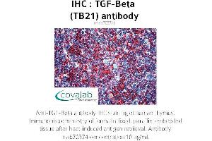 Image no. 1 for anti-TGF-beta (TGFb) antibody (ABIN1723276)
