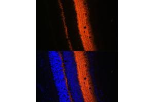 Immunofluorescence analysis of mouse eye using SYT1 Rabbit pAb (ABIN3021249, ABIN3021250, ABIN3021251 and ABIN6214085) at dilution of 1:100 (40x lens). (SYT1 Antikörper  (AA 1-422))