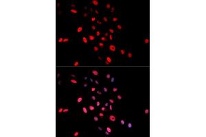 Immunofluorescence (IF) image for anti-Jun Proto-Oncogene (JUN) (pSer63) antibody (ABIN1870292) (C-JUN Antikörper  (pSer63))