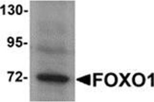 Western blot analysis of FOXO1 in Hela cell lysate with FOXO1 antibody at 1 μg/ml. (FOXO1 Antikörper  (N-Term))