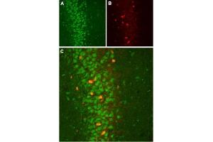 Expression of KCNMB2 in rat hippocampusImmunohistochemical staining of rat hippocampus using Anti-sloβ2 (KCNMB2) Antibody (ABIN7581909).