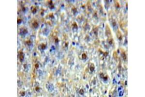 Used in DAB staining on fromalin fixed paraffin-embedded Liver tissue (PSIP1 Antikörper  (AA 311-469))