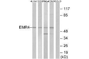 Western blot analysis of extracts from HUVEC cells, COS-7 cells, HeLa cells and COLO cells, using EMR4 antibody. (EMR4 Antikörper  (Internal Region))