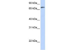 WB Suggested Anti-C14orf37 Antibody Titration:  0. (C14ORF37 Antikörper  (N-Term))