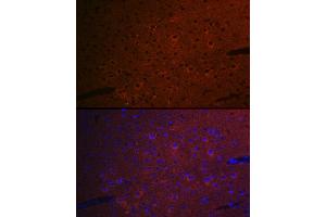 Immunofluorescence analysis of mouse brain cells using CEND1 Rabbit mAb (ABIN7266242) at dilution of 1:100 (40x lens). (CEND1 Antikörper)