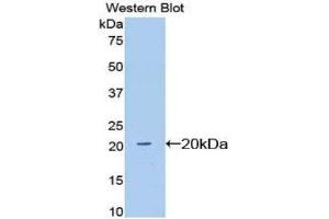 Western Blotting (WB) image for anti-Sialic Acid Binding Ig-Like Lectin 12 (SIGLEC12) (AA 27-141) antibody (ABIN1174413) (SIGLEC12 Antikörper  (AA 27-141))