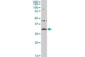 CITED1 monoclonal antibody (M03), clone 5H6 Western Blot analysis of CITED1 expression in A-431 .