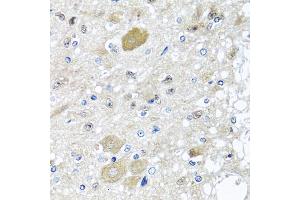 Immunohistochemistry of paraffin-embedded rat brain using CST1 antibody (ABIN5975714) at dilution of 1/100 (40x lens). (CST1 Antikörper)