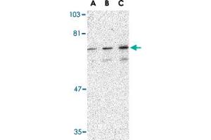 Western blot analysis of PTPN11 in mouse skeletal muscle tissue lysate with PTPN11 polyclonal antibody  at (A) 0. (PTPN11 Antikörper  (C-Term))