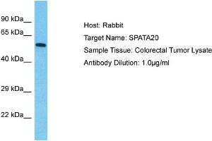 Host: Rabbit Target Name: SPATA20 Sample Type: Colorectal Tumor lysates Antibody Dilution: 1.