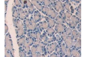 Immunohistochemistry (IHC) image for anti-Urocortin (UCN) (AA 31-121) antibody (ABIN7431422)