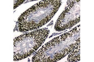 IHC analysis of SAE2/UBA2 using anti-SAE2/UBA2 antibody . (UBA2 Antikörper  (AA 449-564))