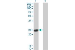 Western Blot analysis of COMT expression in transfected 293T cell line by COMT monoclonal antibody (M01), clone 1G4-1A1. (COMT Antikörper  (AA 1-182))