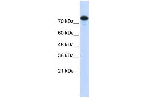 WB Suggested Anti-WWP2 Antibody Titration:  0. (WWP2 Antikörper  (Middle Region))
