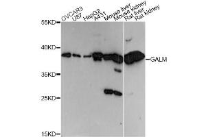 Western blot analysis of extracts of various cell lines, using GALM antibody (ABIN6292969) at 1:3000 dilution. (GALM Antikörper)