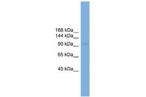 WB Suggested Anti-PIWIL4 Antibody Titration: 0. (PIWIL4 Antikörper  (N-Term))