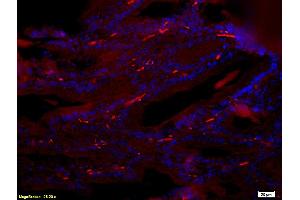 Formalin-fixed and paraffin-embedded : rat breast tissue labeled with Rabbit Anti-Reprimo Polyclonal Antibody (ABIN735863), Unconjugated 1:200 followed by conjugation to the secondary PE antibody and DABI staining