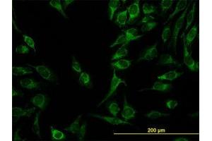 Image no. 4 for anti-Chromosome 21 Open Reading Frame 33 (C21orf33) (AA 188-269) antibody (ABIN599034) (C21orf33 Antikörper  (AA 188-269))