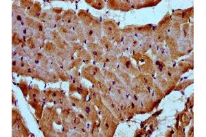 IHC image of ABIN7160664 diluted at 1:300 and staining in paraffin-embedded human heart tissue performed on a Leica BondTM system. (MYOZ2 Antikörper  (AA 90-180))