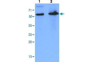 Western blot analysis of cell lysates (each 40 ug) by PDZK1 monoclonal antibody, clone AT1A2  (1:1000). (PDZK1 Antikörper  (AA 1-519))