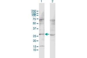 Western Blot analysis of LPHN1 expression in transfected 293T cell line by LPHN1 MaxPab polyclonal antibody. (Latrophilin 1 Antikörper  (AA 1-201))