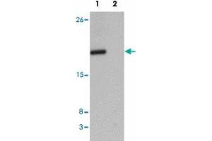 Western blot analysis of CXXC4 in human brain tissue lysate with CXXC4 polyclonal antibody  at 1 ug/mL in (1) the absence and (2) the presence of blocking peptide. (CXXC4 Antikörper  (N-Term))