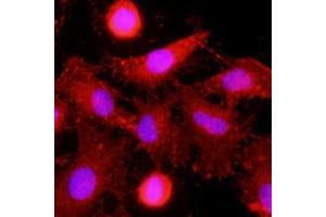 Immunofluorescence of human HeLa cells stained with monoclonal anti-human MINCLE antibody (1:500) with Texas Red (Red). (CLEC4E Antikörper)
