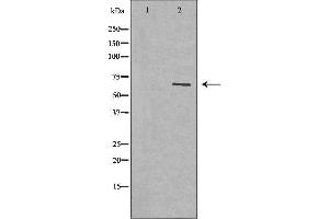 Western blot analysis of extracts of lung tissue, using GPC3 antibody. (Glypican 3 Antikörper  (N-Term))