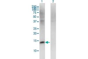 Western Blot analysis of FMN2 expression in transfected 293T cell line by FMN2 monoclonal antibody (M06), clone 1C2. (Formin 2 Antikörper  (AA 144-243))
