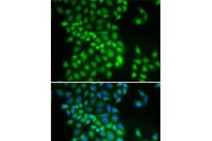 Immunofluorescence analysis of A-549 cells using YTHDC1 Polyclonal Antibody (YTHDC1 Antikörper)
