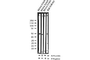 Western blot analysis of Phospho-SRF (Ser99) expression in various lysates