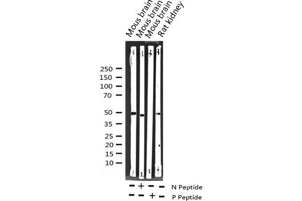 SRF anticorps  (pSer99)
