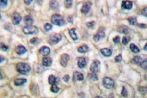 Image no. 1 for anti-Junction Plakoglobin (JUP) antibody (ABIN265337) (JUP Antikörper)