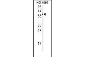 Image no. 1 for anti-Runt-Related Transcription Factor 2 (RUNX2) (Ser6533) antibody (ABIN360019) (RUNX2 Antikörper  (Ser6533))