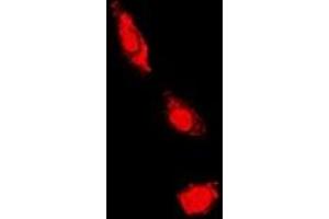 Immunofluorescent analysis of PKC iota/zeta staining in HeLa cells. (PKC iota/zeta Antikörper)