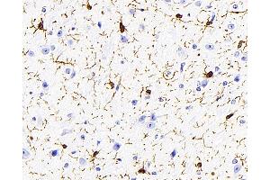 Immunohistochemistry analysis of paraffin-embedded mouse brain using AIF1 Monoclonal Antibody at dilution of 1:400.
