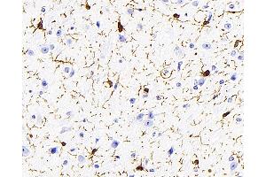 Immunohistochemistry analysis of paraffin-embedded mouse brain using AIF1 Monoclonal Antibody at dilution of 1:400. (Iba1 Antikörper)